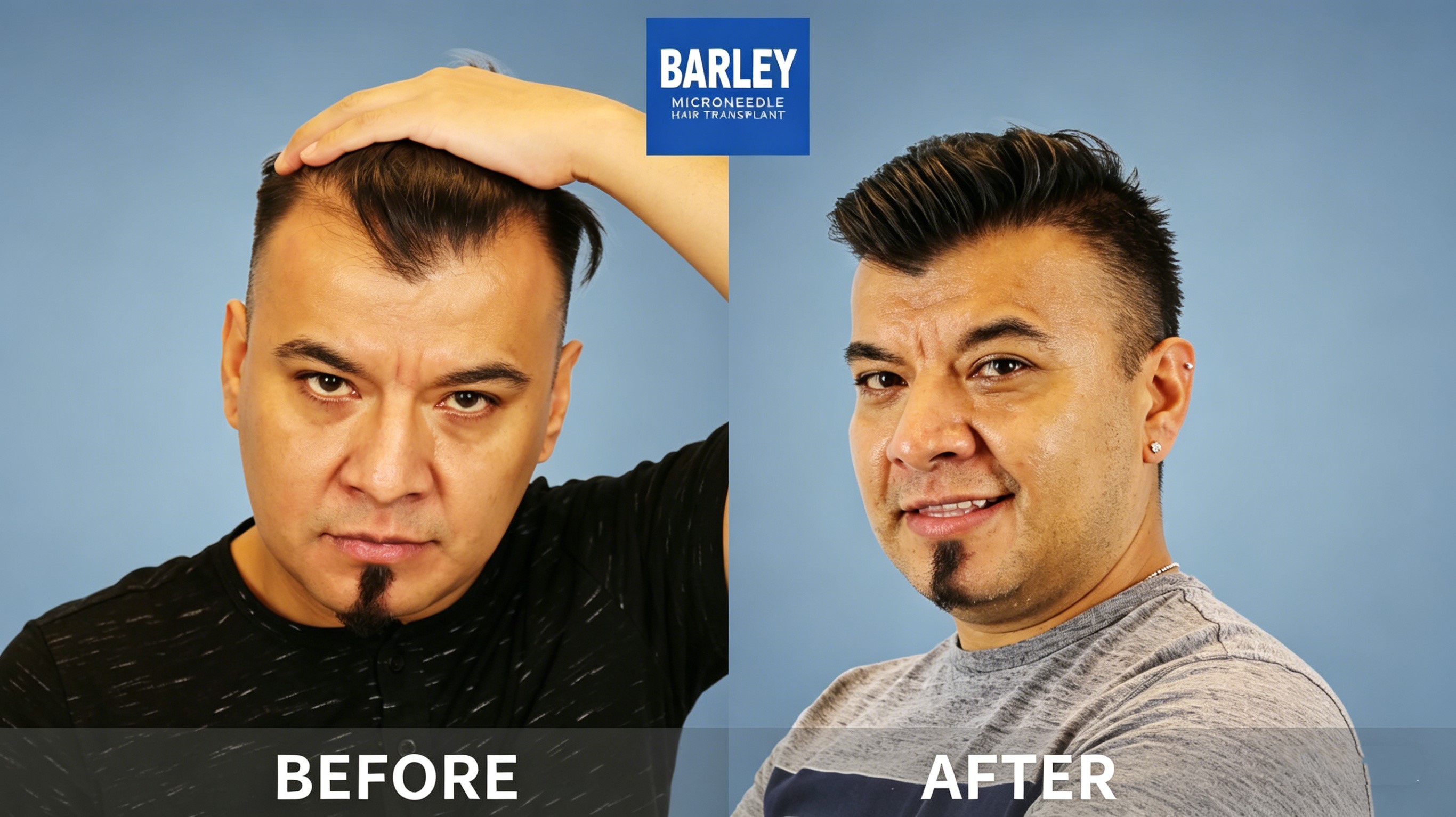 Index - Natural Hair Results