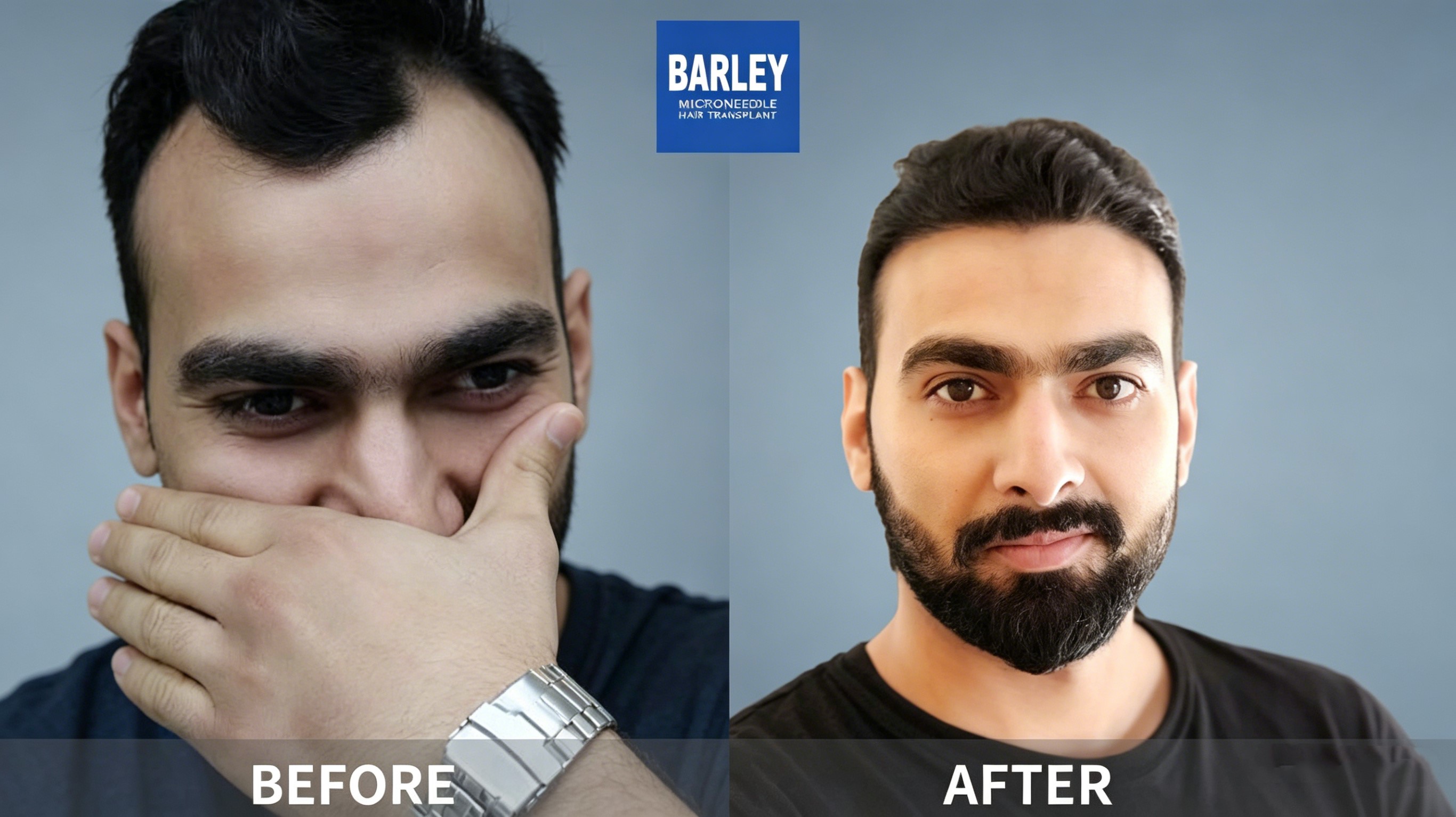 Cases - Expert Hair Restoration