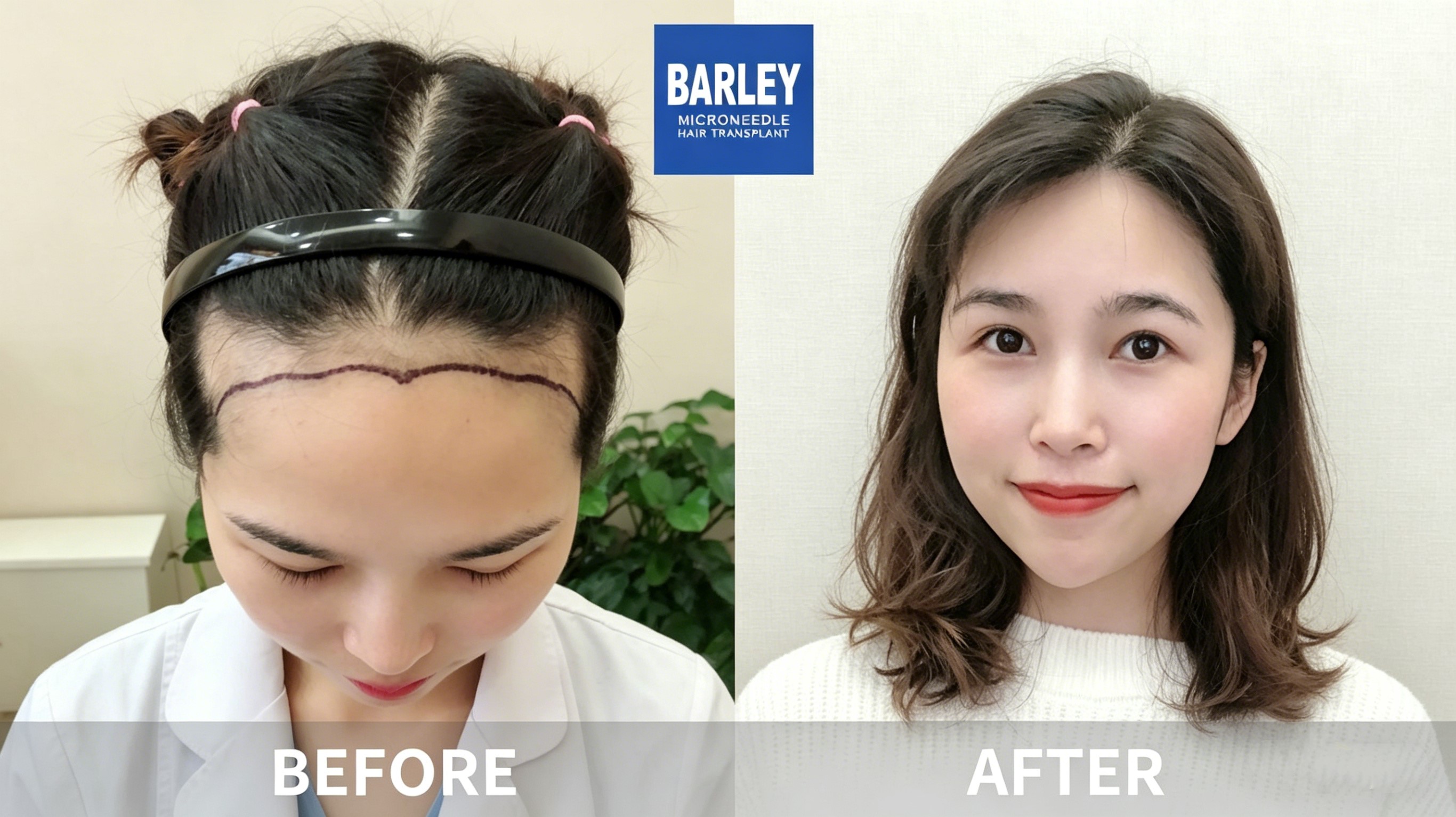 Doctors - Professional Hair Transplant Service
