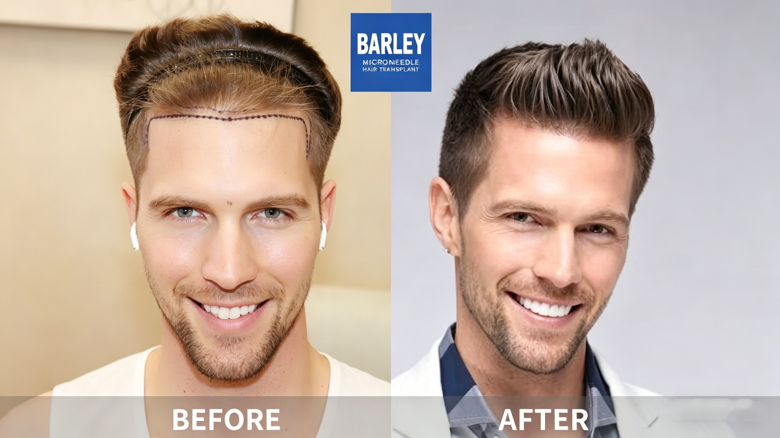 Barley Hair Procedures