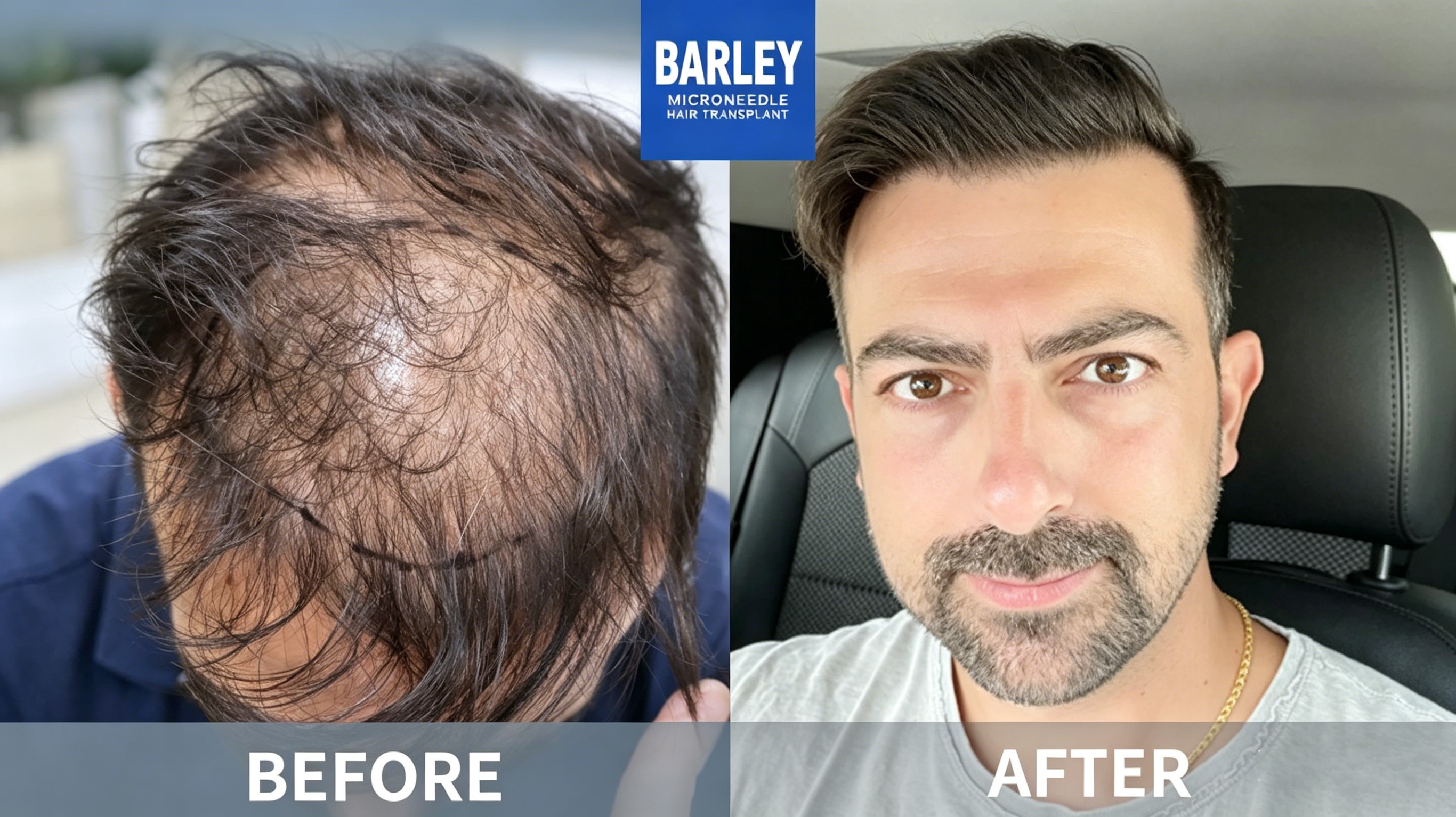 Female Hair Loss Guide - Natural Hair Results