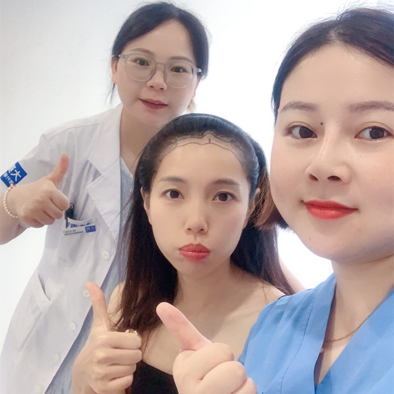 Satisfied FUE patient