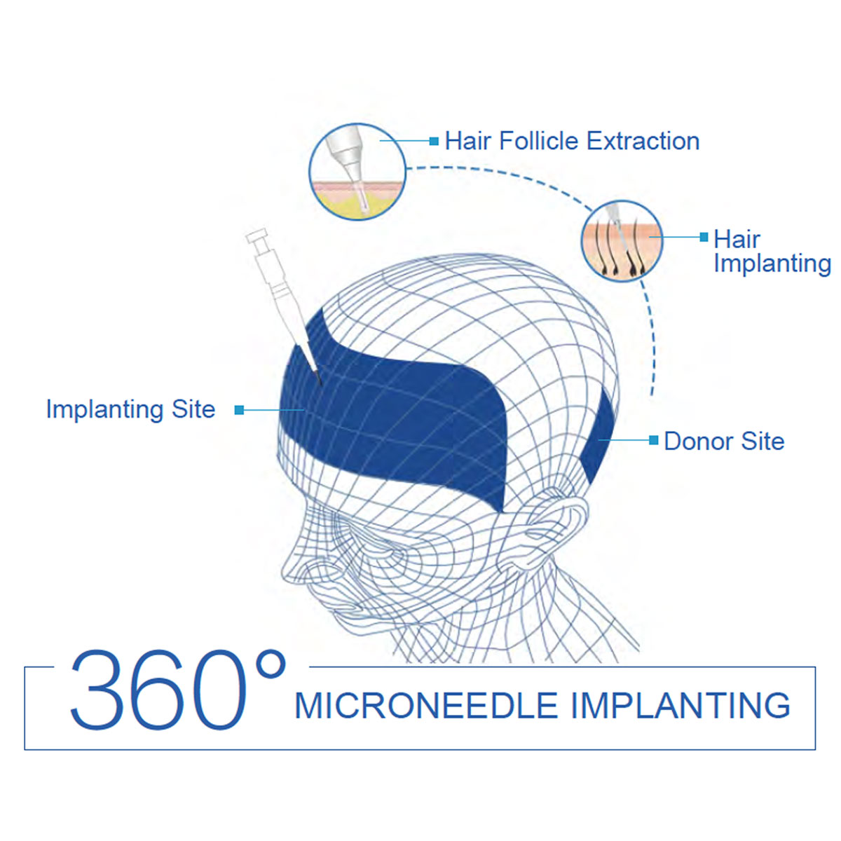 Scar hair transplant consultation