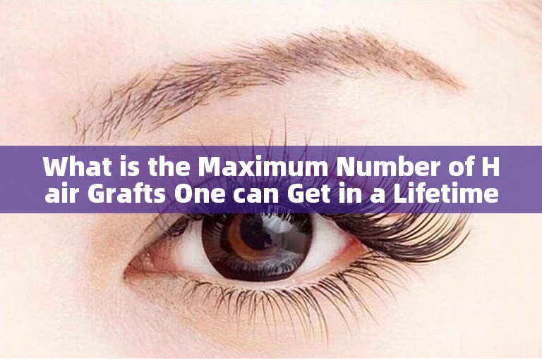 What is the Maximum Number of Hair Grafts One can Get in a Lifetime?