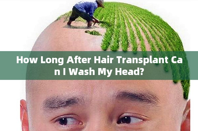 How Long After Hair Transplant Can I Wash My Head?