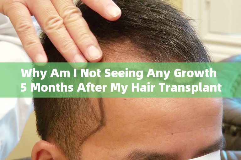 Why Am I Not Seeing Any Growth 5 Months After My Hair Transplant?