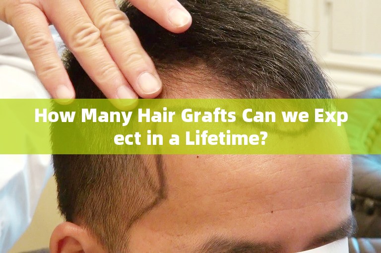 How Many Hair Grafts Can we Expect in a Lifetime?