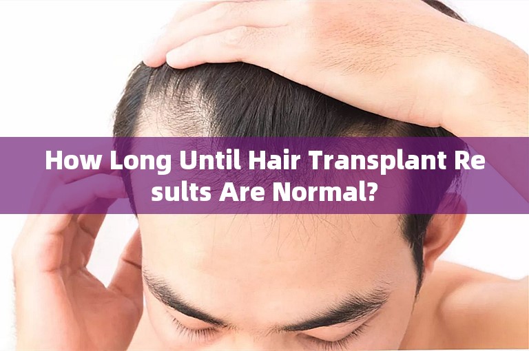 How Long Until Hair Transplant Results Are Normal?