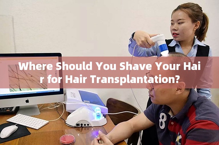 Where Should You Shave Your Hair for Hair Transplantation?
