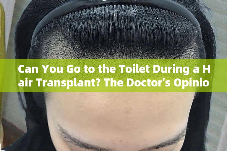 Can You Go to the Toilet During a Hair Transplant? The Doctor's Opinion