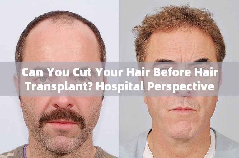 Can You Cut Your Hair Before Hair Transplant? Hospital Perspective on Hair Transplantation Preparation